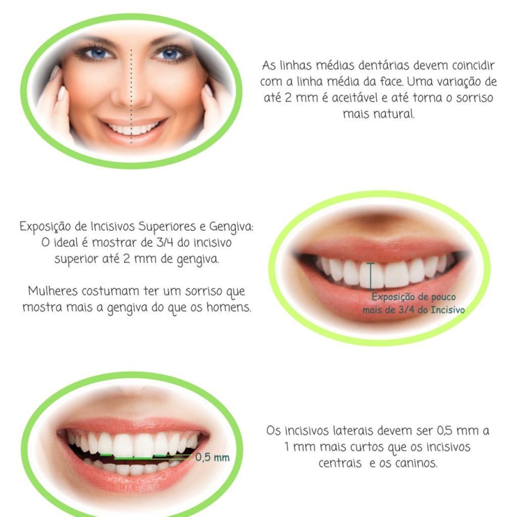 Ariane Sorriso: Dicas e truques para um sorriso perfeito!