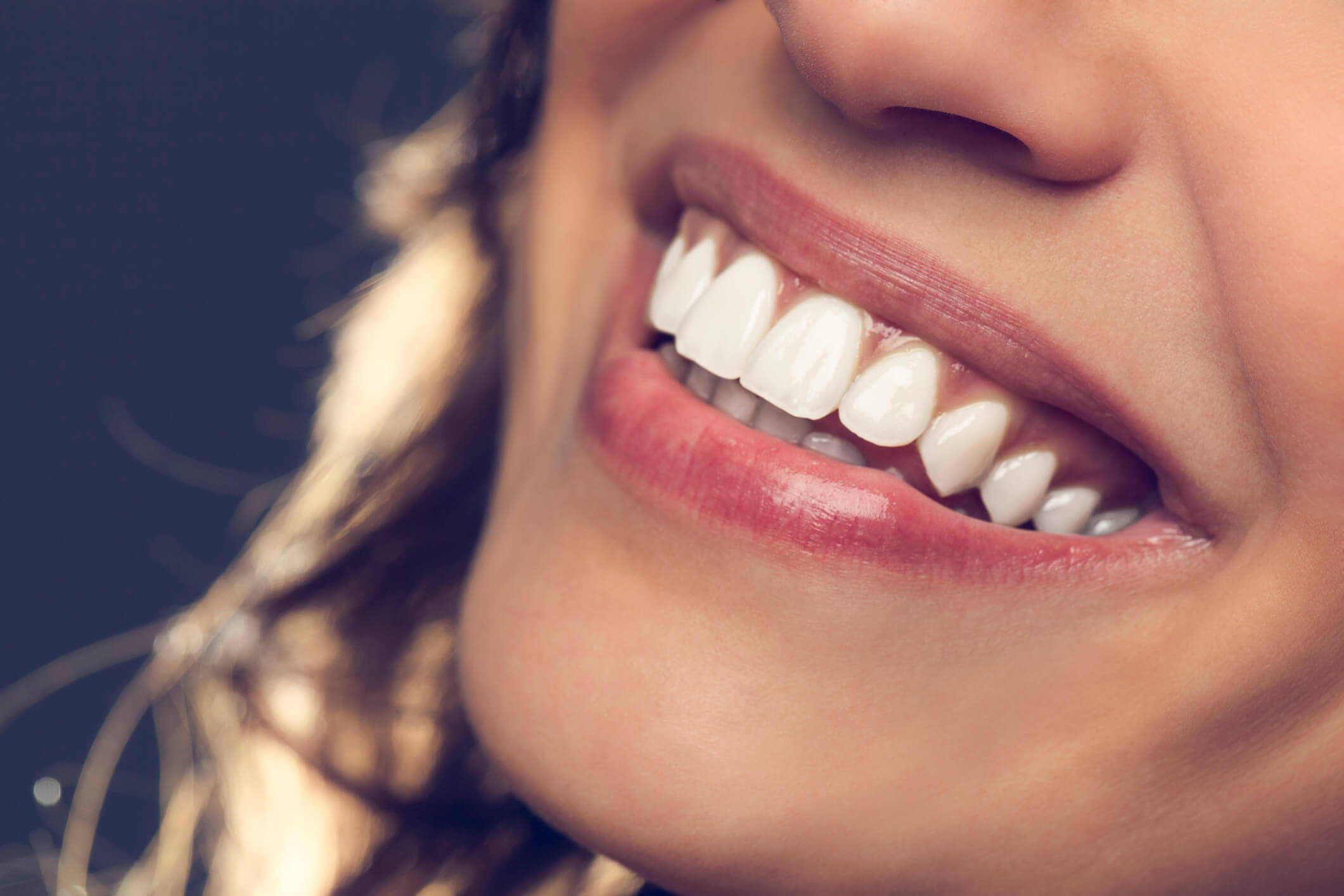 Ariane Sorriso: Dicas e truques para um sorriso perfeito!