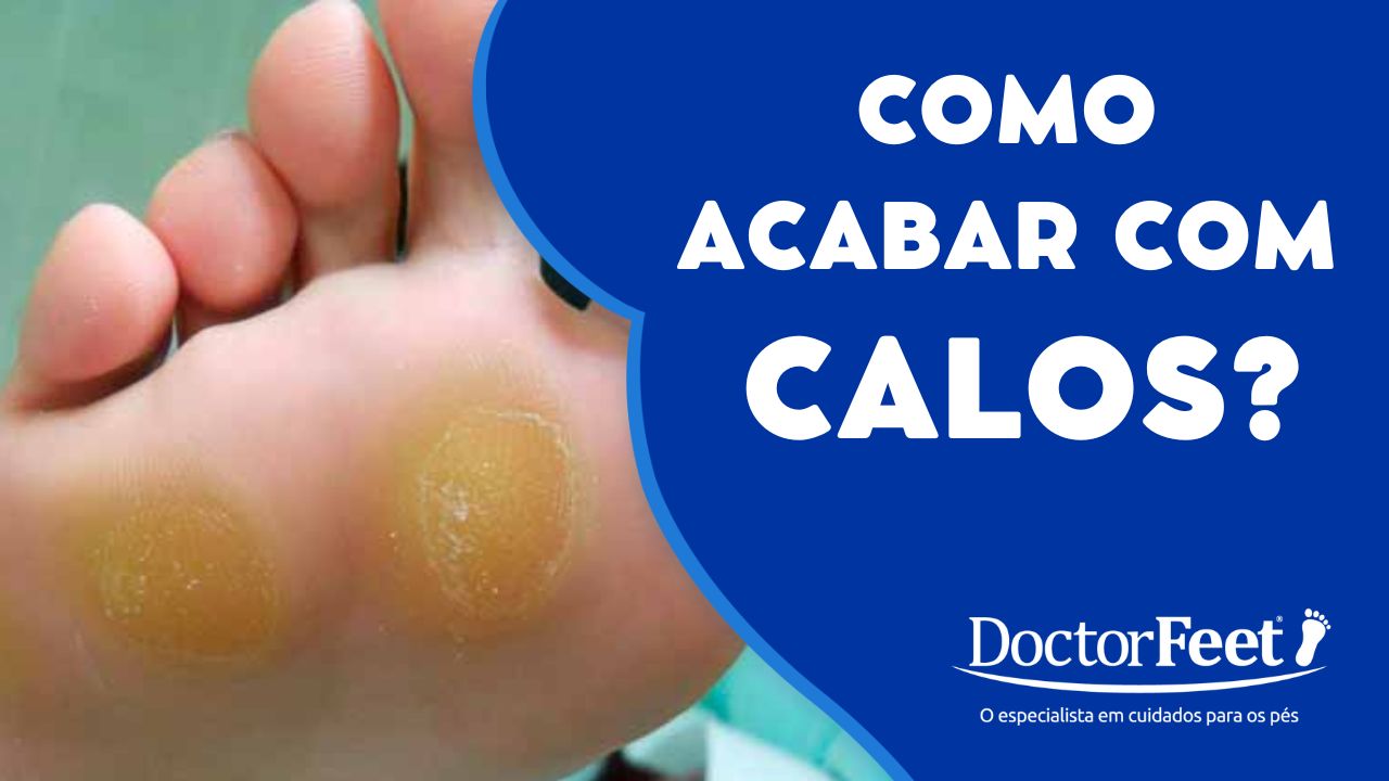Tirar calo no pe (bem fácil)