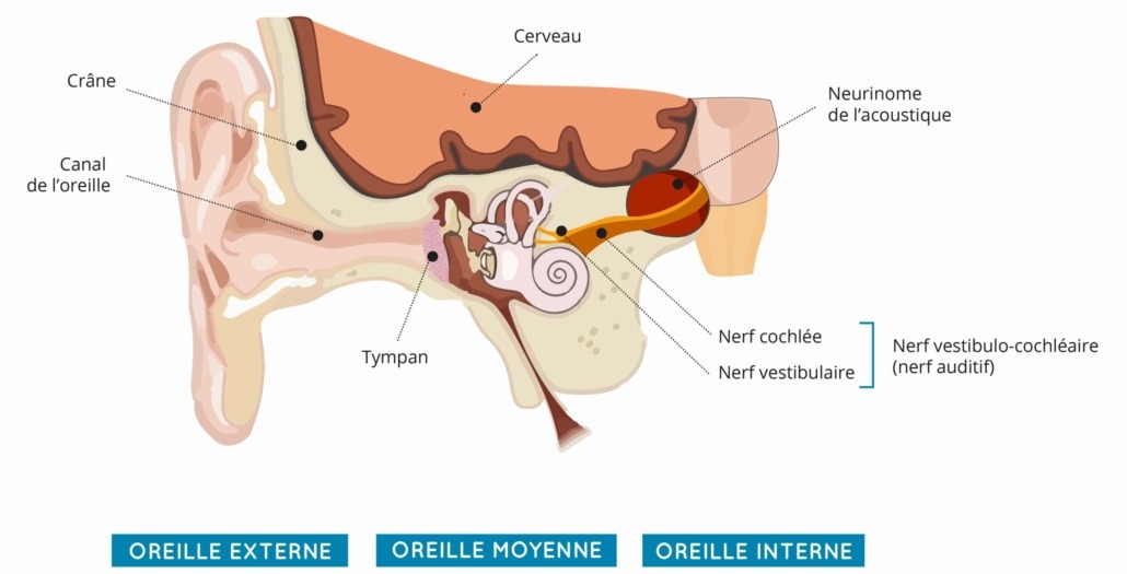 Onde encontrar neurinoma do acústico depoimentos confiáveis hoje?